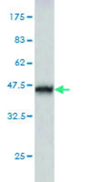 Monoclonal Anti-ABHD5 antibody produced in