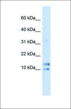 Anti-IL15 antibody produced in rabbit