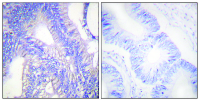 Anti-LYN antibody produced in rabbit