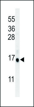 ANTI-MALL (CENTER) antibody produced in