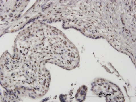 Monoclonal Anti-UBTF antibody produced in