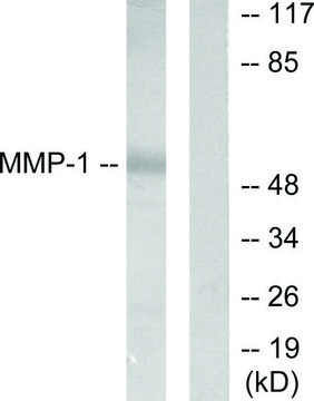 Anti-MMP-1 antibody produced in rabbit