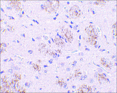 Anti-KLHL1 antibody produced in rabbit