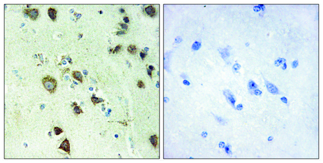 Anti-S6K-?6 antibody produced in rabbit