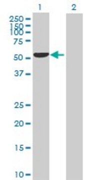 Anti-SERPINA7 antibody produced in rabbit