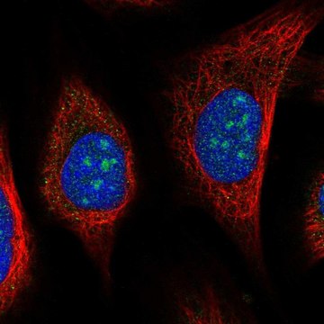 Anti-URB2 antibody produced in rabbit