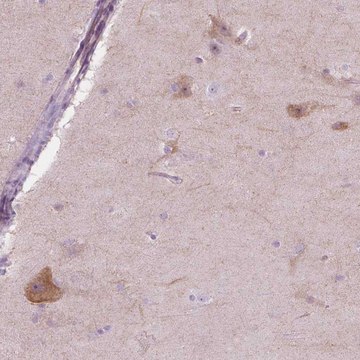 Anti-NOS1AP antibody produced in rabbit