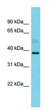 Anti-MARCH8 (N-terminal) antibody produced in