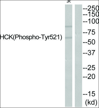Anti-phospho-HCK (pTyr?²¹) antibody produced in