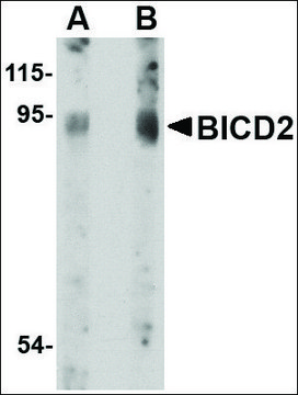 Anti-BICD2 antibody produced in rabbit