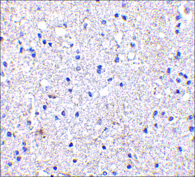 Anti-SCO1 antibody produced in rabbit