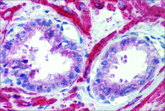 Anti-IGFBP4 antibody produced in rabbit