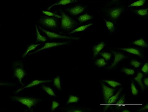 Anti-KRT12 antibody produced in rabbit