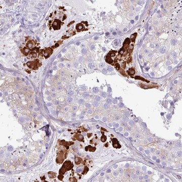 Anti-SLC38A1 antibody produced in rabbit