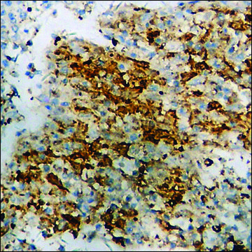 Anti-phospho-PKC-pan (pThr???) antibody produced in