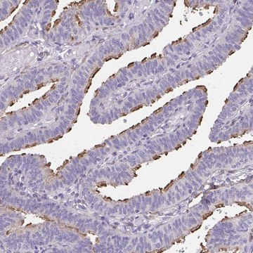 Anti-RUNDC3B antibody produced in rabbit