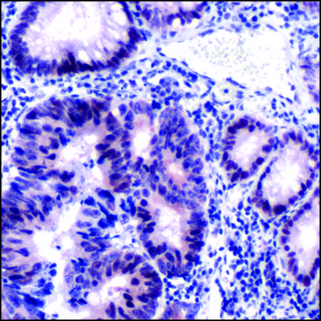Anti-MSH2 antibody, Rabbit monoclonal