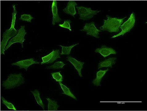 Monoclonal Anti-MR1 antibody produced in
