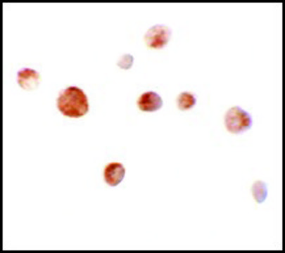 Anti-SLC35D2 antibody produced in rabbit