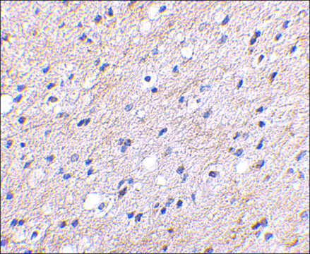 Anti-NIPSNAP (ab2) antibody produced in