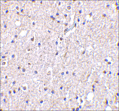 Anti-BRSK2 antibody produced in rabbit