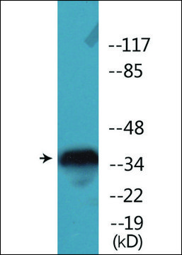 Anti-phospho-IkappaB-? (pSer²²) antibody produced in