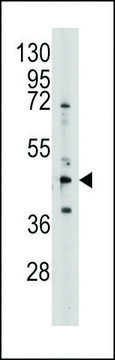 ANTI-S ADENOSYLHOMOCYSTEINE HYDROLASE (ACHY)(N-TERMINAL) antibody