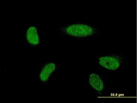 ANTI-ATOH1 antibody produced in mouse
