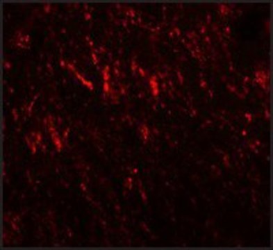Anti-PRICKLE2 antibody produced in rabbit
