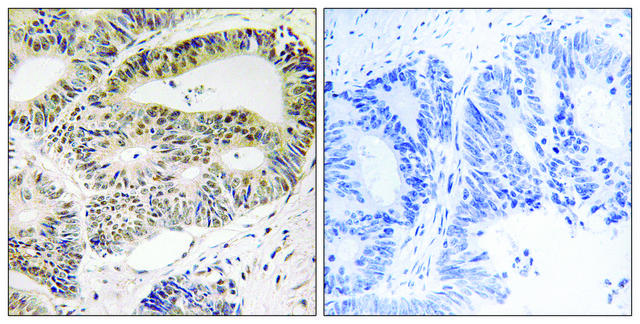Anti-OSR1 antibody produced in rabbit