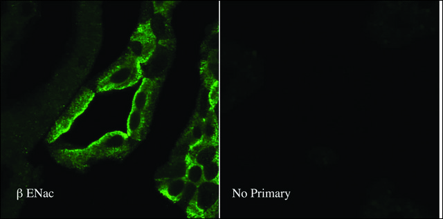 Anti-SCNN1B antibody produced in rabbit