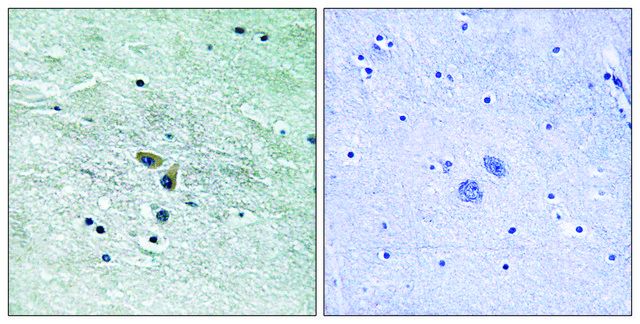 Anti-MAP3K8 antibody produced in rabbit