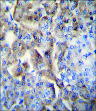 ANTI-TMEM90A (C-TERM) antibody produced in
