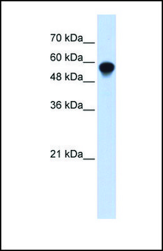 Anti-IRF6 antibody produced in rabbit