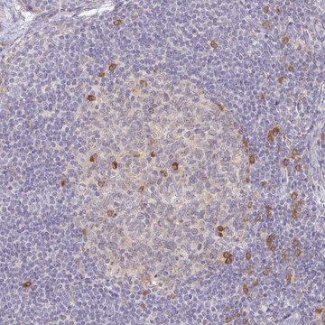Anti-DERL2 antibody produced in rabbit