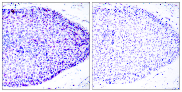 Anti-ATF2 antibody produced in rabbit