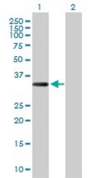 Anti-COL23A1 antibody produced in rabbit