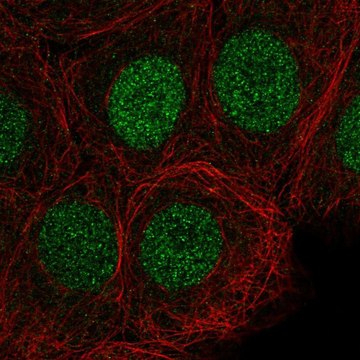 Anti-SIRT6 antibody produced in rabbit