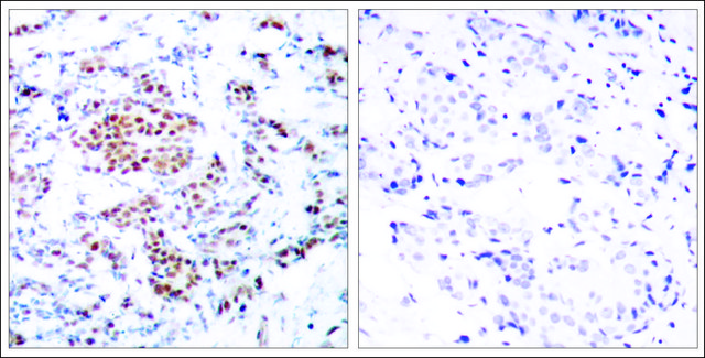 Anti-STAT5A (Ab-694) antibody produced in