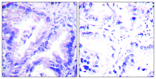 Anti-PP2A-? antibody produced in rabbit