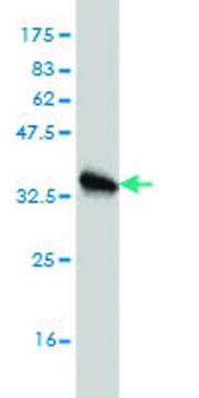 Monoclonal Anti-HBB antibody produced in
