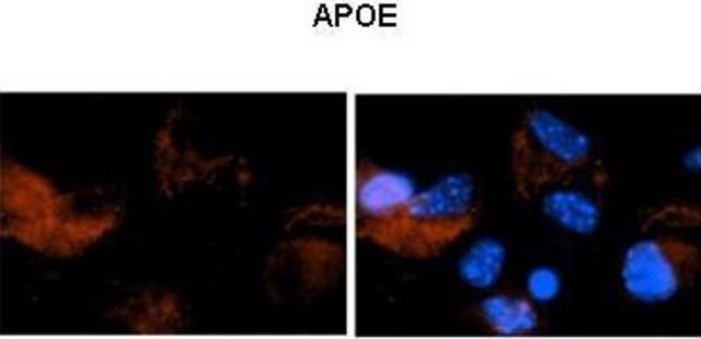 Anti-APOE (N-terminal) antibody produced in