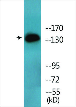 Anti-phospho-EGFR (pSer¹??¹) antibody produced in