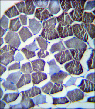 ANTI-NPHP3 (N-TERM) antibody produced in