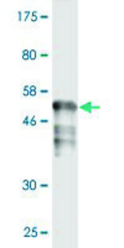 Monoclonal Anti-RAD51 antibody produced in