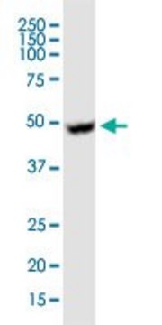 Monoclonal Anti-UGCG antibody produced in