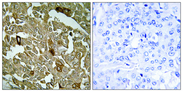 Anti-BTBD6 antibody produced in rabbit