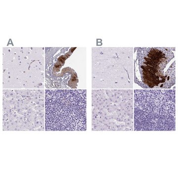 Anti-KRT12 antibody produced in rabbit