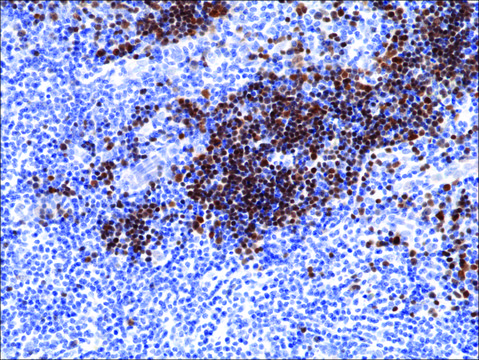 Anti-Terminal deoxynucleotidyl transferase (TdT) antibody,