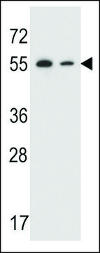 ANTI-TRIM7 (N-TERMINAL) antibody produced in